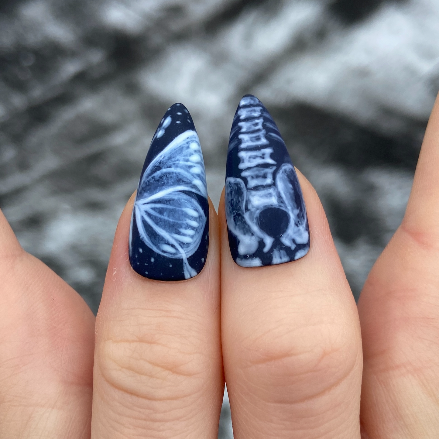 X-RAY