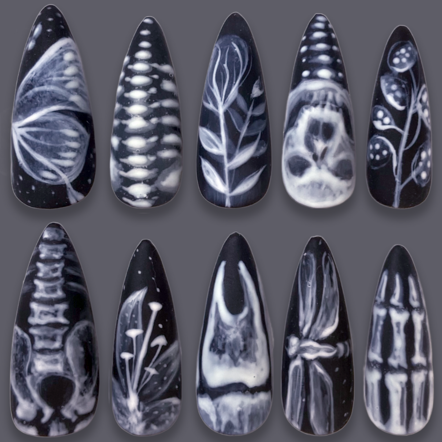 X-RAY